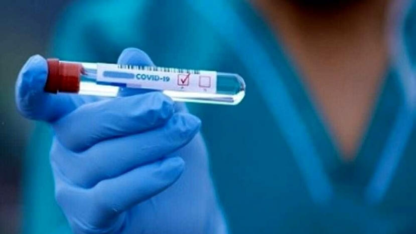 Coronavirus: sono 1.597 I positivi registrati ad oggi con 163 nuovi casi nelle 24 ore e 10 decessi. La Valle d’Aosta a zero contagi
