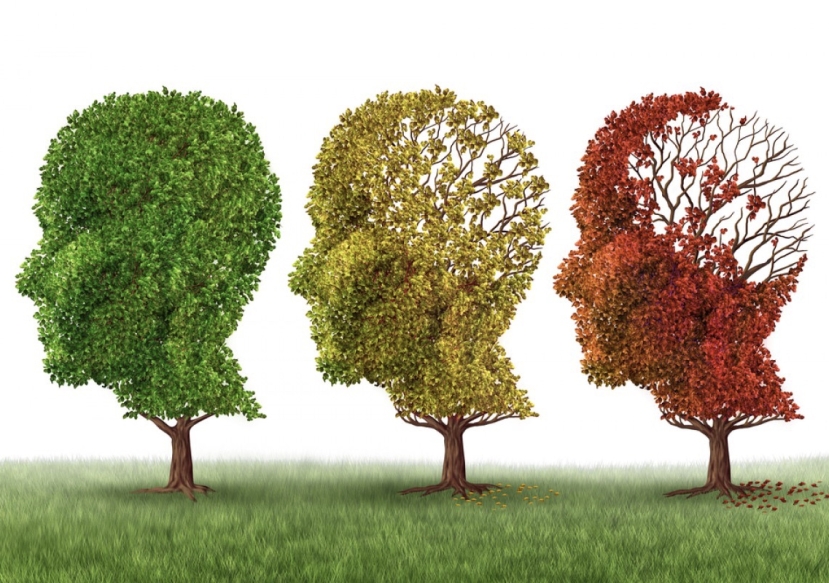 Alzheimer: la Food and Drug Administration autorizza il farmaco Leqembi che influenza il processo patologico
